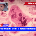 Florida Is One of 15 States Affected by the Nationwide Measles Outbreak