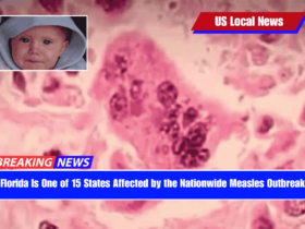 Florida Is One of 15 States Affected by the Nationwide Measles Outbreak