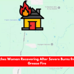 Nacogdoches Woman Recovering After Severe Burns from House Grease Fire